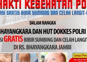 program khusus Operasi Bibir Sumbing dan Celah Langit-langit (foto: Ist)